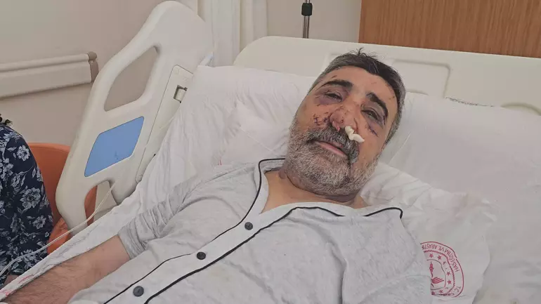 ISIRMAYA ÖPMEYE ÇALIŞTI